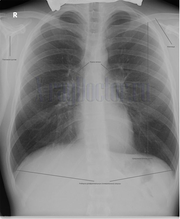 снимок с описанием основных рентгеновских структур